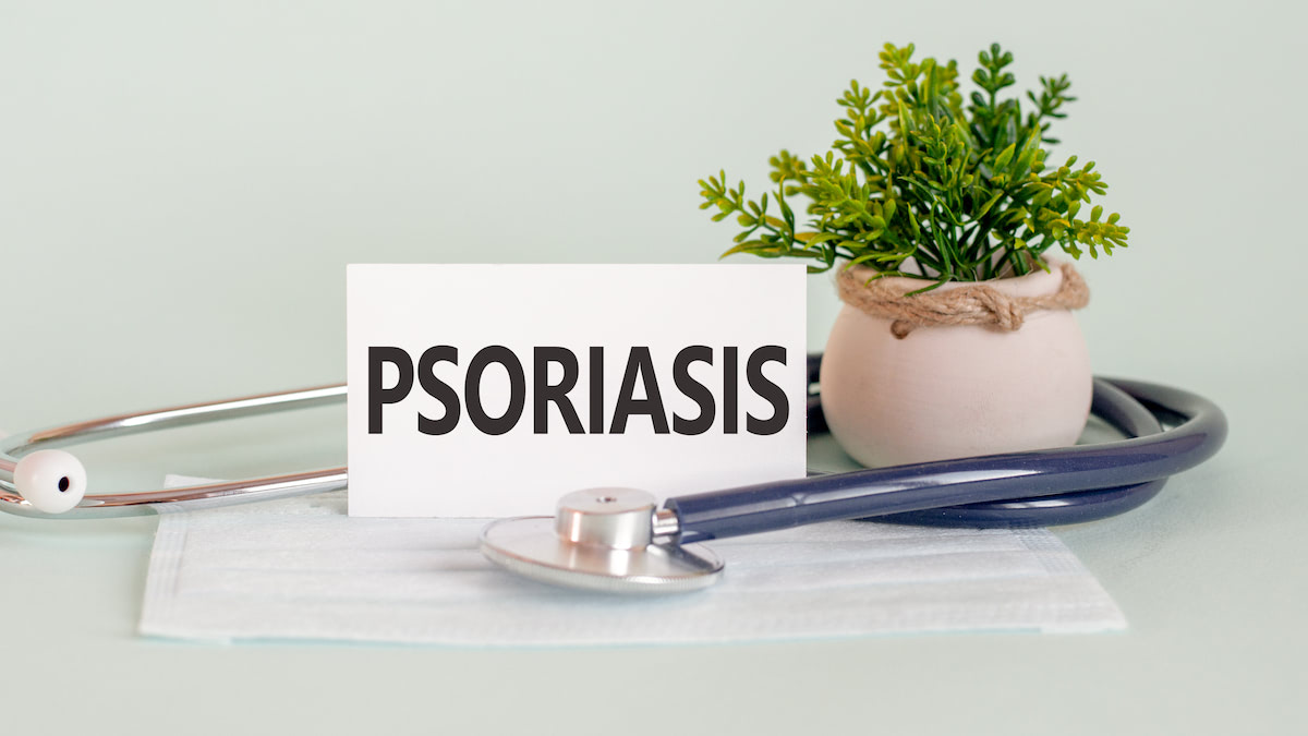 Psoriasis - Who treats psoriasis and is psoriasis curable? What can you do about it yourself?