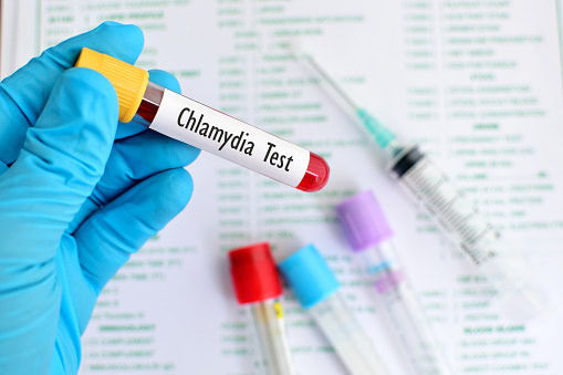 Whether contact with chlamydia has occurred can also be determined by detecting corresponding antibodies in a blood sample.