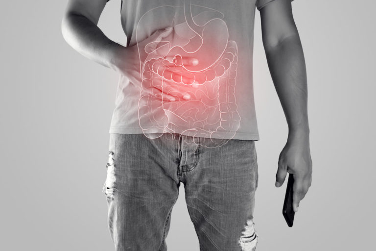 Important information and help with ulcerative colitis