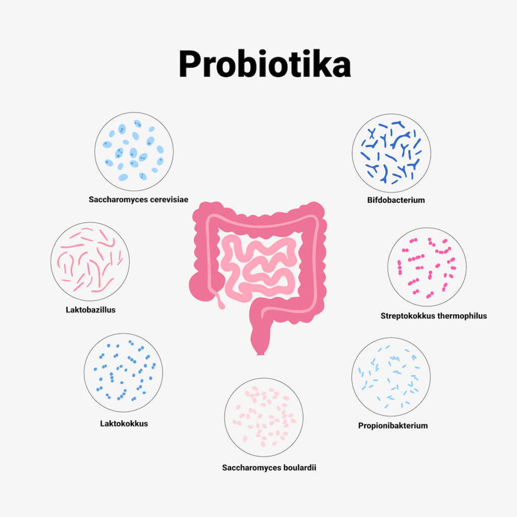 Probiotics for ulcerative colitis
