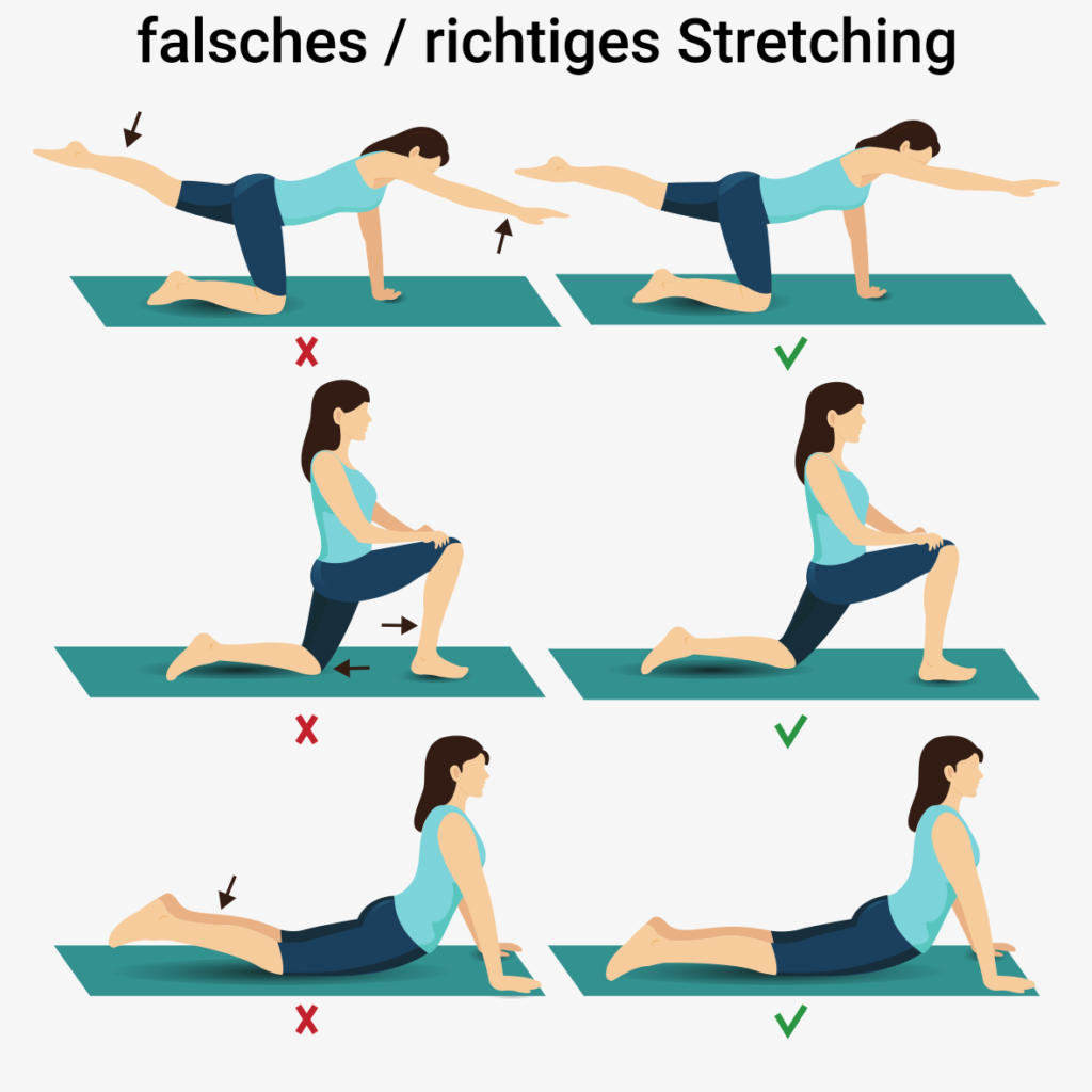 Stretching bei Spinalstenose